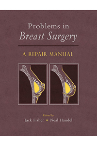 copertina di Problems in Breast Surgery: A Repair Manual