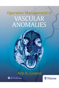 copertina di Operative Management of Vascular Anomalies