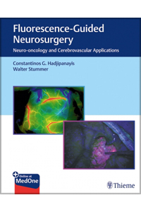 copertina di Fluorescence - Guided Neurosurgery - Neuro - oncology and Cerebrovascular Applications