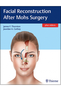 copertina di Facial Reconstruction After Mohs Surgery