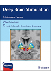 copertina di Deep Brain Stimulation - Techniques and Practices