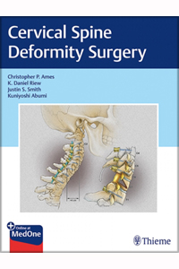 copertina di Cervical Spine Deformity Surgery