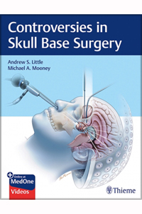 copertina di Controversies in Skull Base Surgery