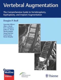 copertina di Vertebral Augmentation - The Comprehensive Guide to Vertebroplasty, Kyphoplasty, ...