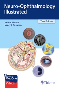 copertina di Neuro - Ophthalmology Illustrated