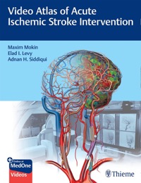 copertina di Video Atlas of Acute Ischemic Stroke Intervention
