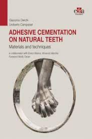 copertina di Adhesive cementation on natural teeth. Materials and techniques