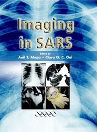 copertina di Imaging in SARS