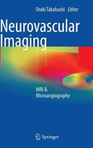 copertina di Neurovascular Imaging - MRI ( Magnetic resonance imaging ) and Microangiography