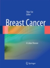 copertina di Breast Cancer - A Lobar Disease