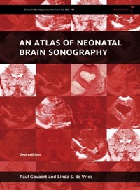 copertina di An Atlas of Neonatal Brain Sonography