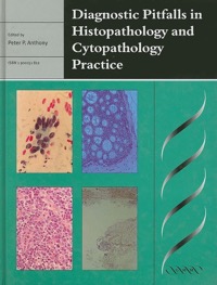 copertina di Diagnostic Pitfalls in Histopathology and Cytopathology Practice