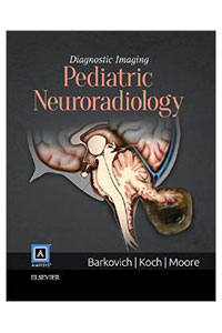 copertina di Diagnostic Imaging : Pediatric Neuroradiology