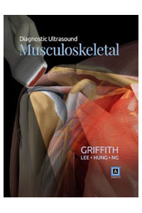 copertina di Diagnostic Ultrasound: Musculoskeletal