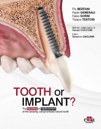 copertina di Tooth or Implant? The recovery or replacement of the severely compromised natural ...
