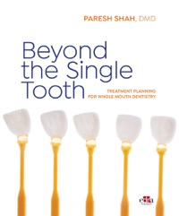 copertina di Beyond the Single Tooth - Treatment planning for Whole Mouth Dentistry