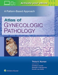 copertina di Atlas of Gynecologic Pathology - A Pattern - based Approach
