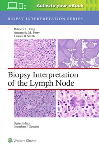 copertina di Biopsy Interpretation of the Lymph Node