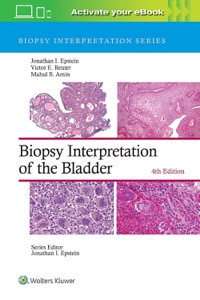 copertina di Biopsy Interpretation of the Bladder 