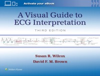 copertina di A Visual Guide to ECG Interpretation