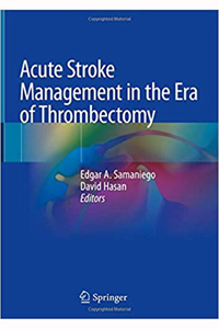 copertina di Acute Stroke Management in the Era of Thrombectomy