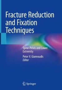 copertina di Fracture Reduction and Fixation Techniques - Spine Pelvis and Lower Extremity