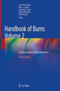 copertina di Handbook of Burns - Reconstruction and Rehabilitation