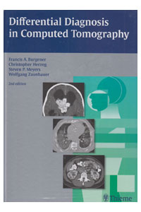 copertina di Differential Diagnosis in  Computed Tomography ( CT )