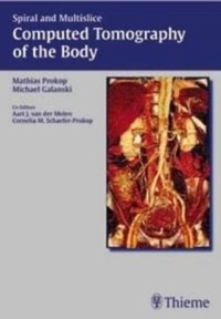 copertina di Spiral and Multislice Computed Tomography of the Body