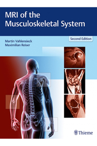 copertina di MRI ( Magnetic resonance imaging ) of the Musculoskeletal System