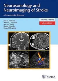 copertina di Neurosonology and Neuroimaging of Stroke - A Comprehensive Reference ( videos included ...