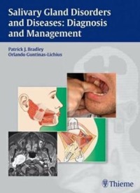 copertina di Salivary Gland Disorders and Diseases : Diagnosis and Management
