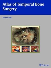 copertina di Atlas of Temporal Bone Surgery
