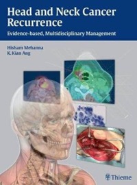copertina di Head and Neck Cancer Recurrence : Evidence - based, Multidisciplinary Management