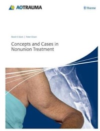 copertina di Concepts and Cases in Nonunion Treatment