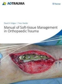 copertina di Manual of Soft - tissue Management in Orthopaedic Trauma - DVD included