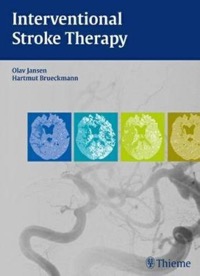 copertina di Interventional Stroke Therapy