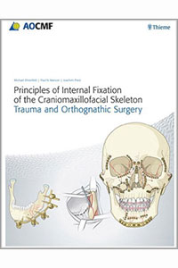copertina di Principles of Internal Fixation of the Craniomaxillofacial Skeleton
