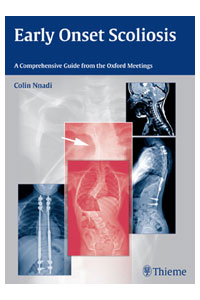 copertina di Early Onset Scoliosis - A Comprehensive Guide from the Oxford Meetings