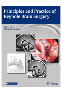 copertina di Principles and Practice of Keyhole Brain Surgery