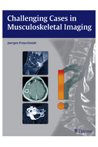 copertina di Challenging Cases in Musculoskeletal Imaging
