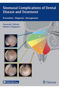 copertina di Sinonasal Complications of Dental Disease and Treatment - Prevention - Diagnosis ...