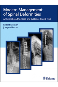 copertina di Modern Management of Spinal Deformities - A Theoretical, Practical, and Evidence ...