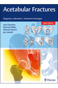 copertina di Acetabular Fractures - Diagnosis, Indications, Treatment Strategies