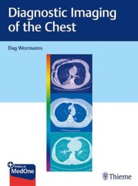 copertina di Diagnostic Imaging of the Chest