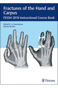 copertina di Fractures of the Hand and Carpus - FESSH 2018 Instructional Course Book