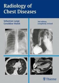copertina di Radiology of Chest Diseases