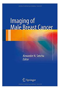 copertina di Imaging of Male Breast Cancer