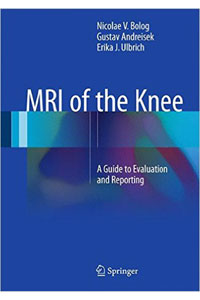copertina di MRI ( Magnetic Resonance Imaging ) of the Knee - A Guide to Evaluation and Reporting