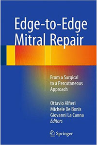 copertina di Edge - to - Edge Mitral Repair - From a Surgical to a Percutaneous Approach